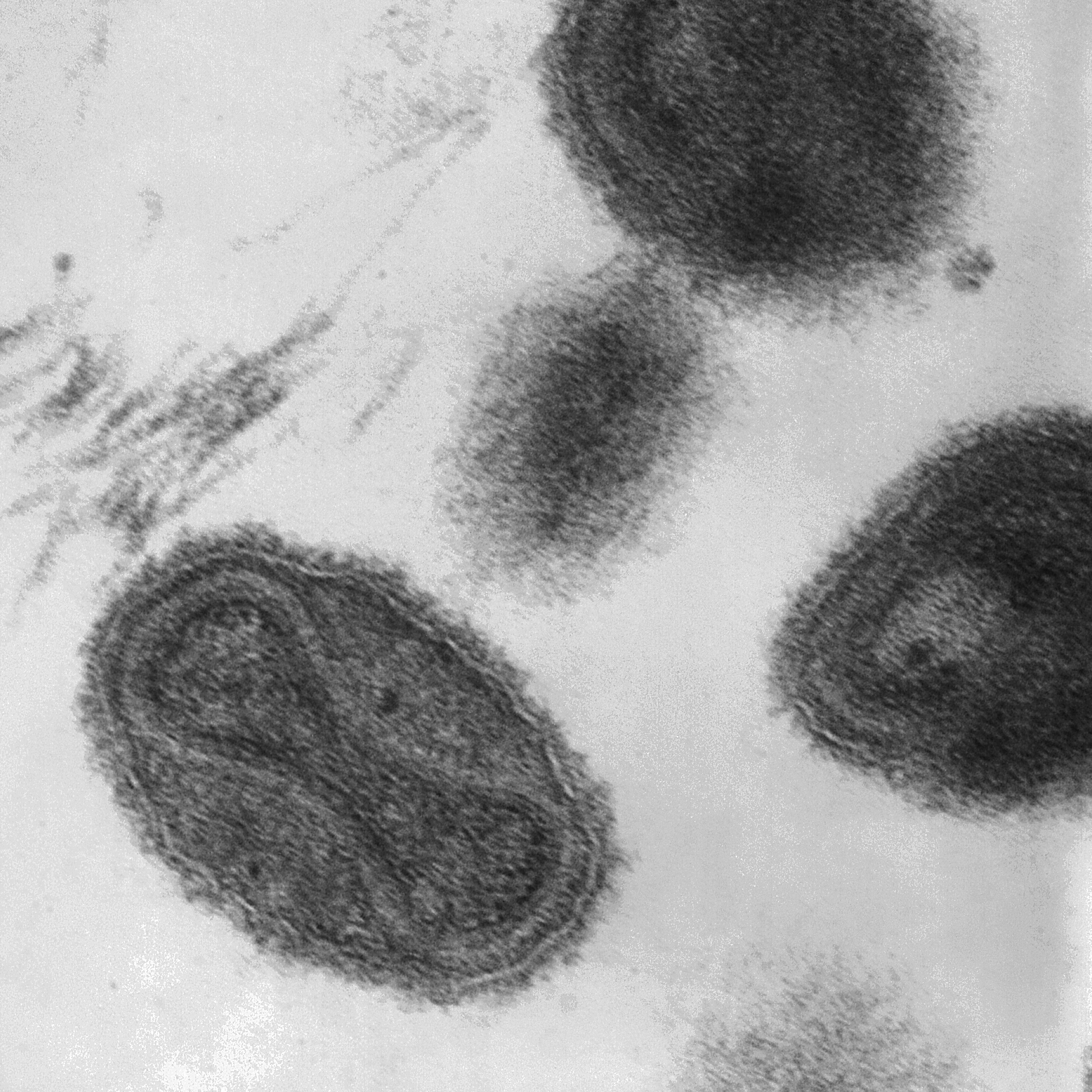 The smallpox virusunder a microscope.