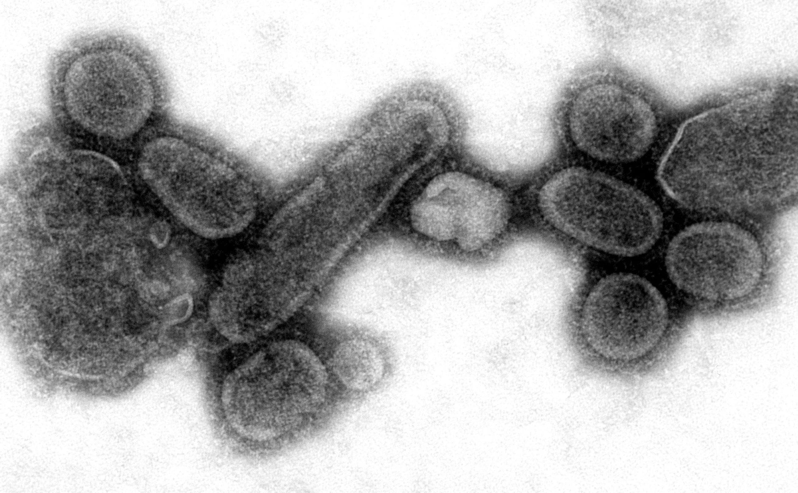 An electron micrograph showing recreated 1918 influenza virions