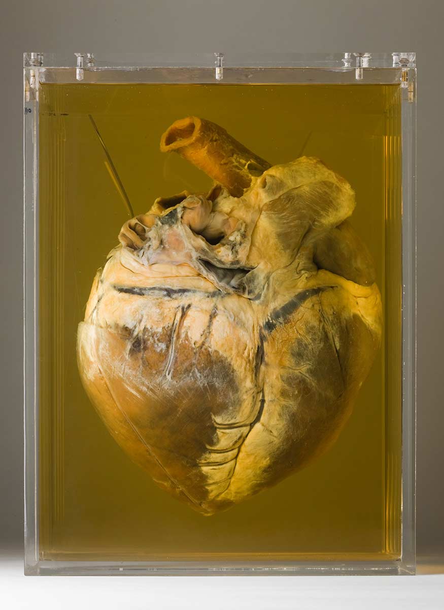 Phar Lap’s heart.